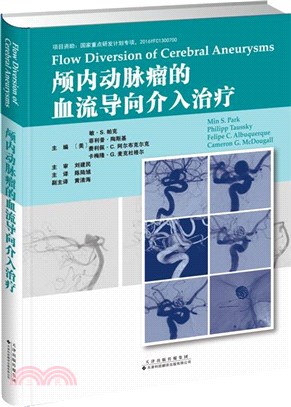 顱內動脈瘤的血流導向介入治療（簡體書）