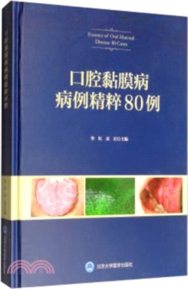 口腔黏膜疑難病例精粹80例(2016北醫基金)（簡體書）