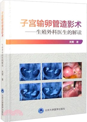 子宮輸卵管造影術：生殖外科醫生的解讀(精)（簡體書）
