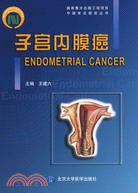 子宮內膜癌(中國常見癌症叢書)（簡體書）