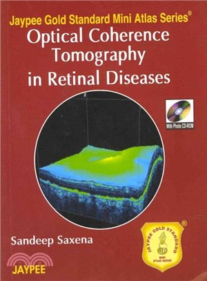 Optical Coherence Tomography in Retinal Diseases