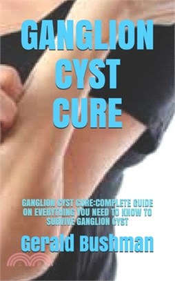 Ganglion Cyst Cure: Ganglion Cyst Cure: Complete Guide on Everything You Need to Know to Survive Ganglion Cyst