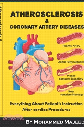 Atherosclerosis & Coronary Artery Disease: Everything About Patient's Instruction After cardiac Procedures