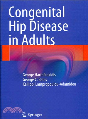 Congenital Hip Disease in Adults