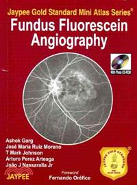 Fundus Flourescien Angiography
