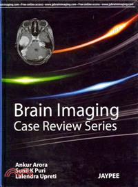 Brain Imaging