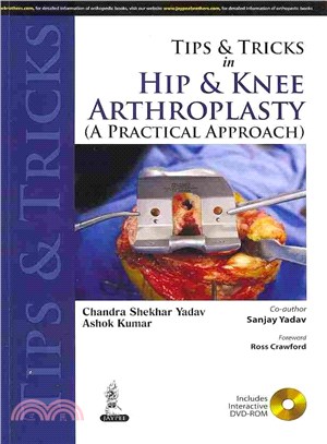 Tips and Tricks in Hip and Knee Arthroplasty ― A Practical Approach