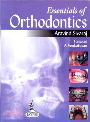 Essentials of Orthodontics
