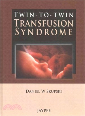 Twin-to-Twin Transfusion Syndrome