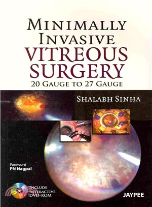 Minimally Invasive Vitreous Surgery ― 20 Gauge to 27 Gauge