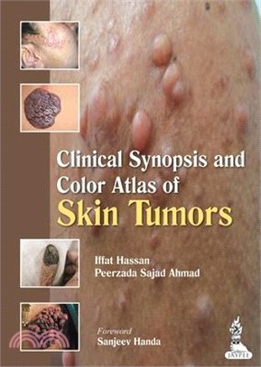 Clinical Synopsis and Color Atlas of Skin Tumors