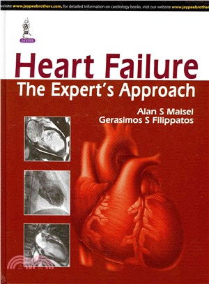Heart Failure ― The Expert's Approach