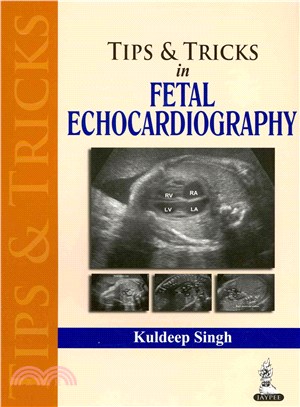 Tips & Tricks in Fetal Echocardiography