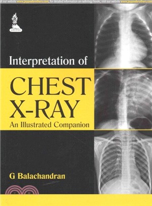 Interpretation of Chest X-Ray ― An Illustrated Companion