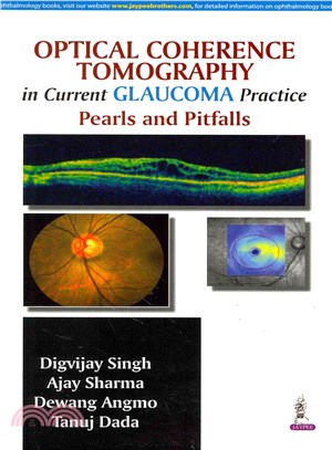 Optical Coherence Tomography in Current Glaucoma Practice ― Pearls and Pitfalls