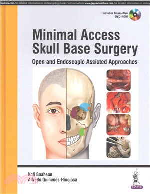 Minimal Access Skull Base Surgery ─ Open and Endoscopic Assisted Approaches