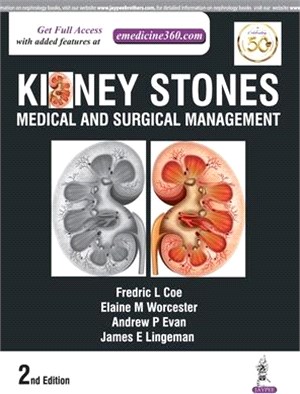 Kidney Stones ─ Medical and Surgical Management