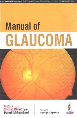 Manual of Glaucoma