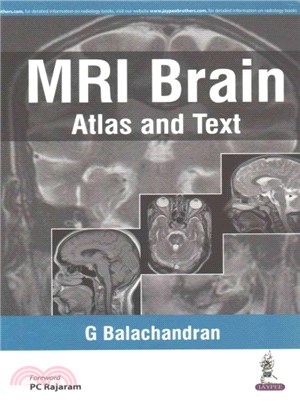 MRI Brain ― A Mini Atlas and Text