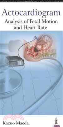 Actocardiogram ─ Analysis of Fetal Motion and Heart Rate
