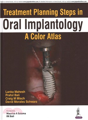 Treatment Planning Steps in Oral Implantology ― A Color Atlas