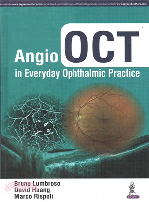 Angio OCT in Everyday Ophthalmic Practice