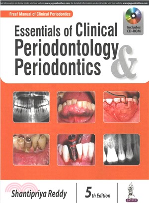 Essentials of Clinical Periodontology & Periodontics