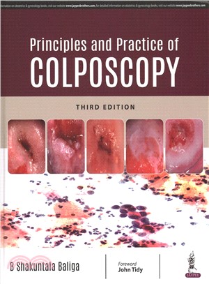 Principles and Practice of Colposcopy