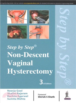 Non-descent Vaginal Hysterectomy