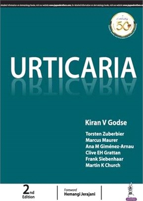 Urticaria