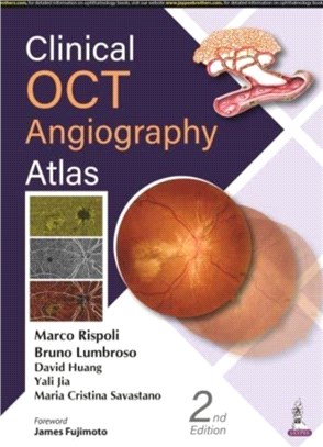 Clinical OCT Angiography Atlas