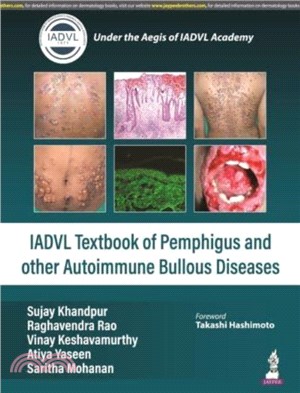 Textbook of Pemphigus and other Autoimmune Bullous Diseases