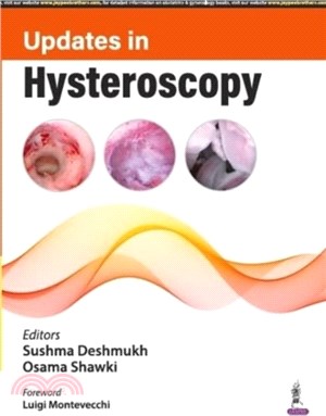 Updates in Hysteroscopy