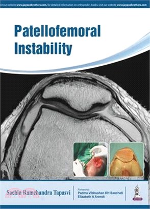 Patellofemoral Instability ─ Knee Joint