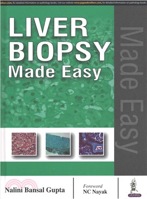 Liver Biopsy Made Easy