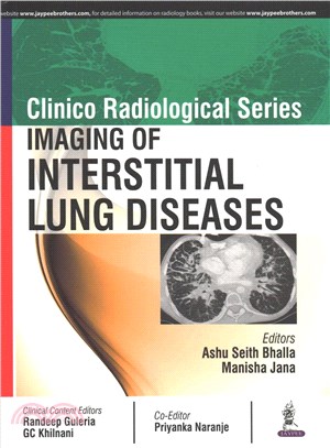 Imaging of Interstitial Lung Diseases