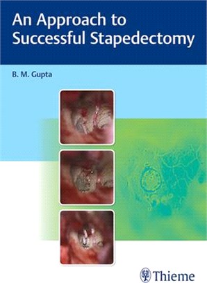 An Approach to Successful Stapedectomy