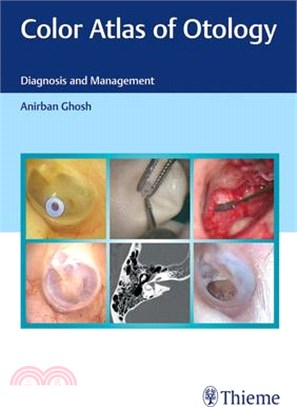 Color Atlas of Otology: Diagnosis and Management