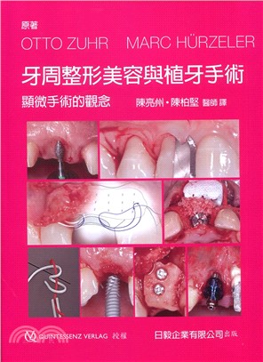 牙周整形美容與植牙手術：顯微手術的觀念