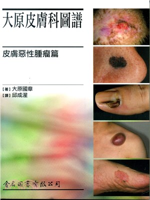 大原皮膚科圖譜：皮膚惡性腫瘤篇