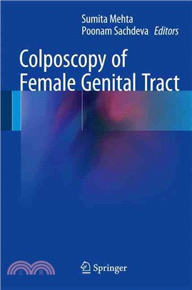 Colposcopy of female genital...