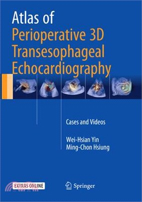 Atlas of Perioperative 3d Transesophageal Echocardiography ― Cases and Videos