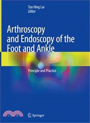 Arthroscopy and endoscopy of the foot and ankleprinciple and practice /