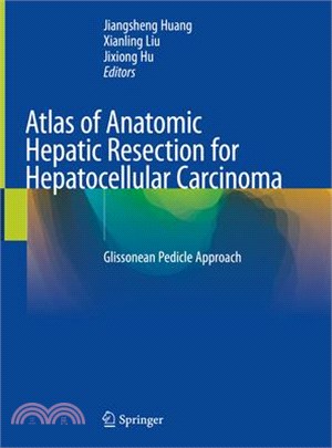 Atlas of Anatomic Hepatic Resection for Hepatocellular Carcinoma ― Glissonean Pedicle Approach