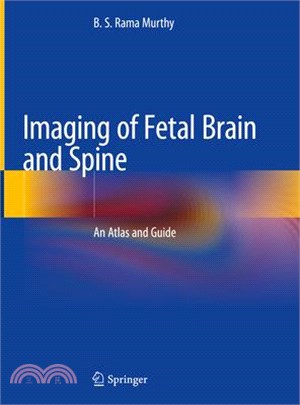 Imaging of Fetal Brain and Spine ― An Atlas and Guide