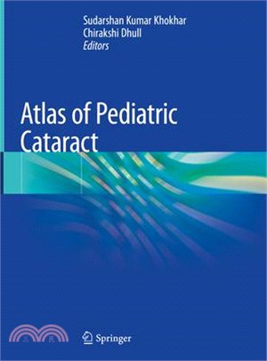 Atlas of Pediatric Cataract