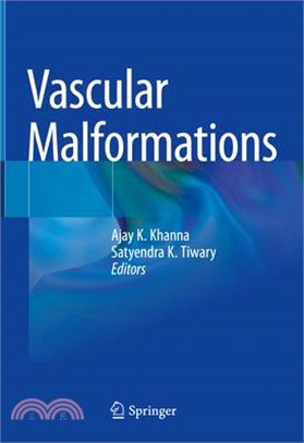 Vascular Malformations