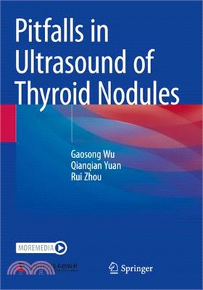 Pitfalls in Ultrasound of Thyroid Nodules