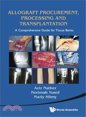 Allograft Procurement, Processing and Transplantation — A Comprehensive Guide for Tissue Bank