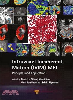 Intravoxel Incoherent Motion Ivim MRI ― Principles and Applications